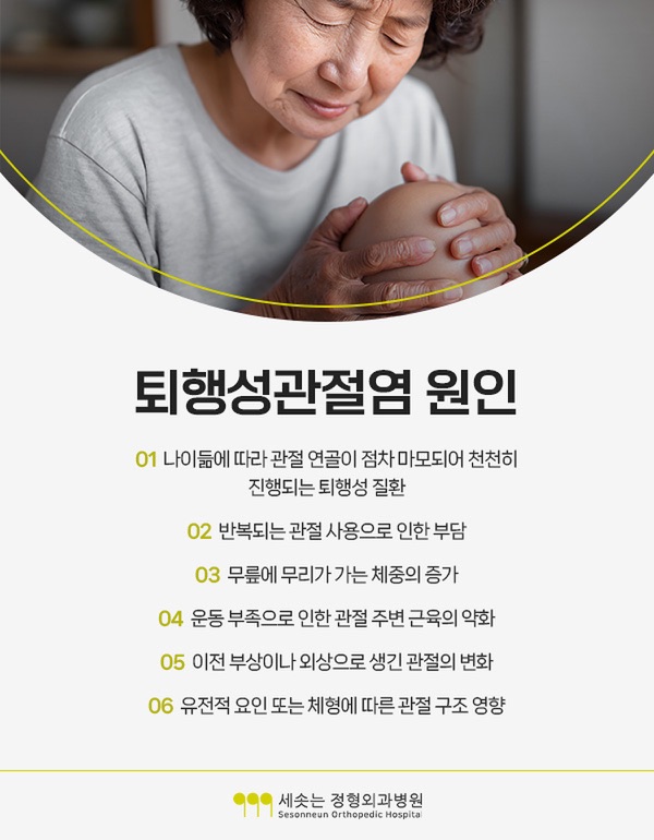 퇴행성관절염 원인 여섯 가지 — 나이듦에 따라 관절 연골이 점차 마모되어 천천히 진행되는 퇴행성 질환, 반복되는 관절 사용으로 인한 부담, 무릎에 무리가 가는 체중의 증가, 운동 부족으로 인한 관절 주변 근육의 약화, 이전 부상이나 외상으로 생긴 관절의 변화, 유전적 요인 또는 체형에 따른 관절 구조 영향
